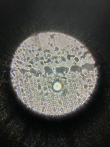 Thumbnail for LGP 25 - The Ever-Overscaled Onion