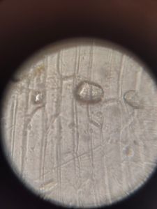 Thumbnail for PCAM 26 - Onion peel 