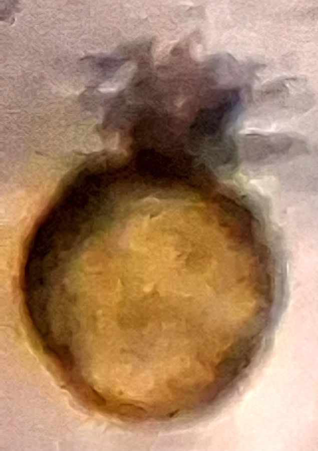 SINGLE IMAGE