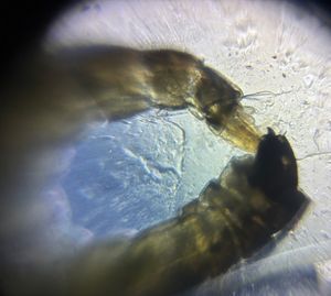 Thumbnail for Aquatic Invertebrate Larva