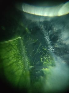 Thumbnail for LGP26:B4 - Leaf, Dark Field Imagery