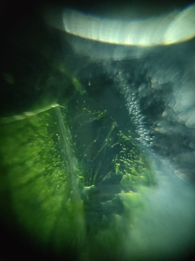 SINGLE IMAGE