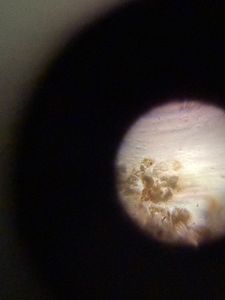 Thumbnail for Sea water diatoms, spotted in a slide with sea water sample. 
