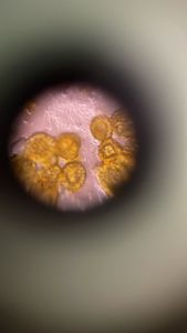 Thumbnail for LGP 26 - Day 3 - Pollen Grain (Part 1)
