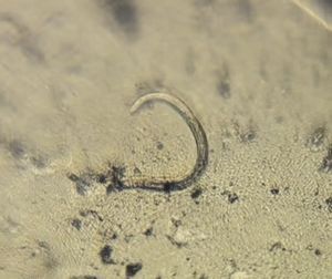 Thumbnail for Nematodes