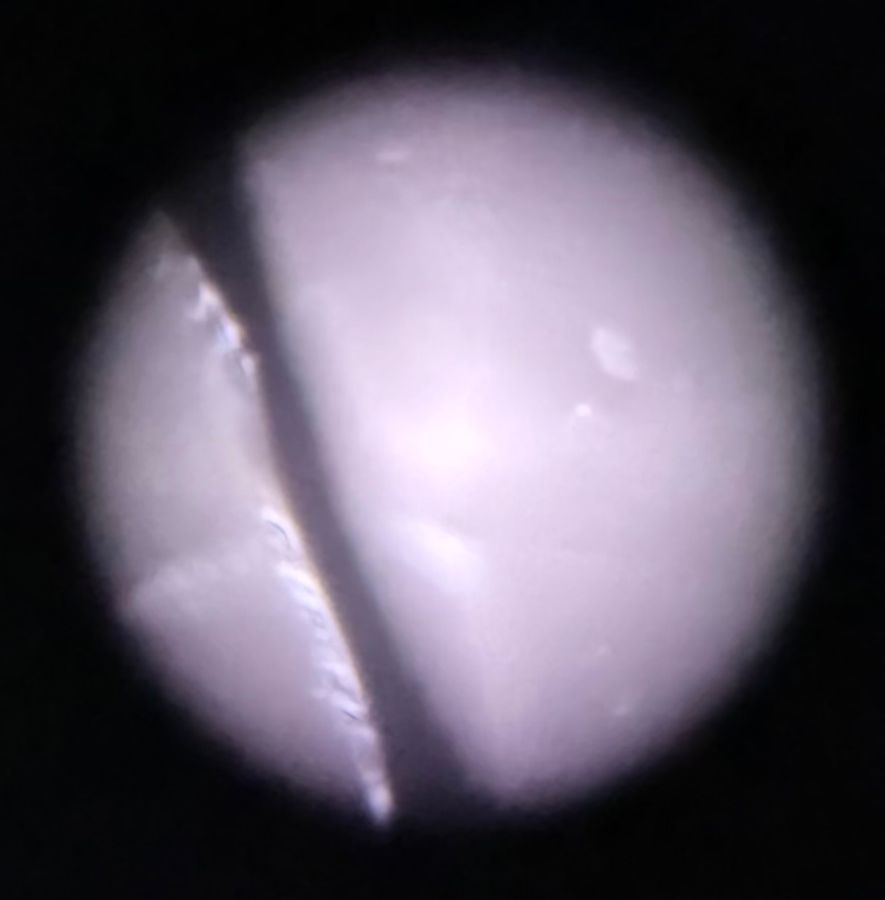 SINGLE IMAGE