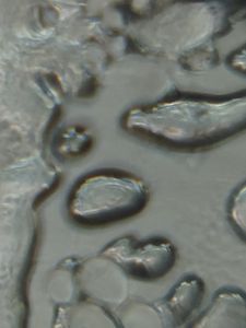 Thumbnail for LGP 26 - B2 | Day - 2 | Potato Starch
