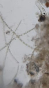 Thumbnail for Algal formation in stagnant water 