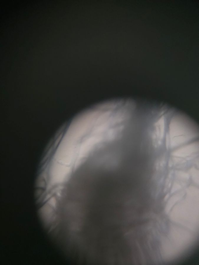 SINGLE IMAGE