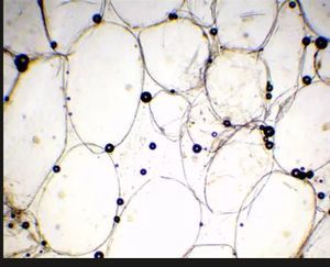 Thumbnail for Amazing Journey Inside a Tomato Cell
