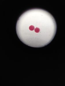 Thumbnail for FOLDSCOPE WORKSHOP METTUPALAYAM