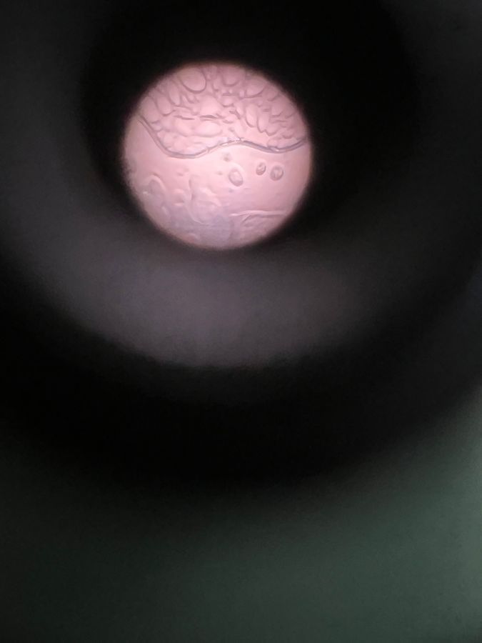 SINGLE IMAGE