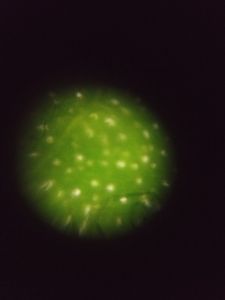 Thumbnail for Stomata