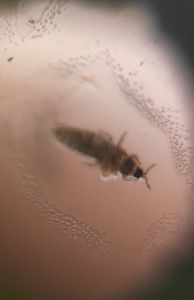 Thumbnail for LGP B-2 DAY 3 Random insect found on floor