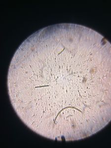 Thumbnail for Microscopic Observation: Freshwater Microorganisms at 140x