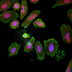 After deconvolution