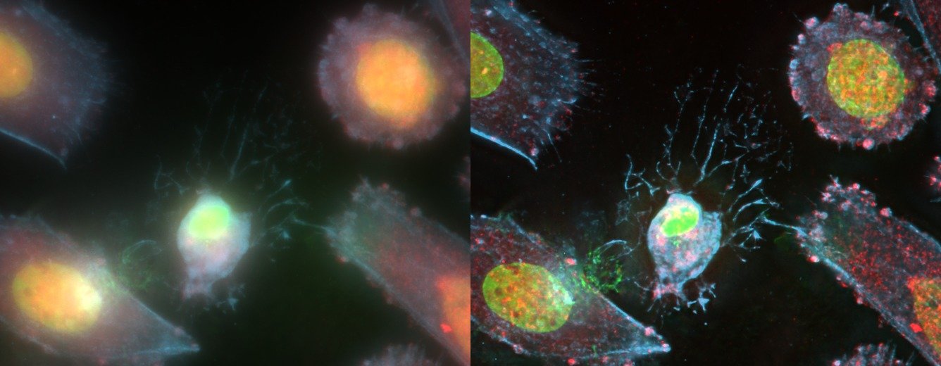 Deconvolved in 2 seconds.<br/>Human osteosarcoma cell line SaOS2.