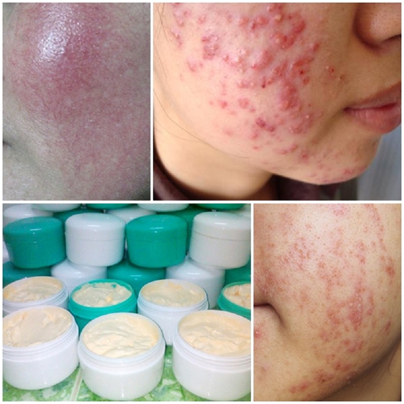 kem trắng da 7 day