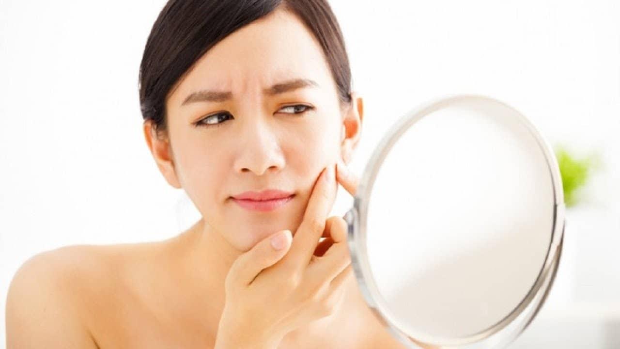 Tự ý nặn mụn khiến hình thành vết thâm