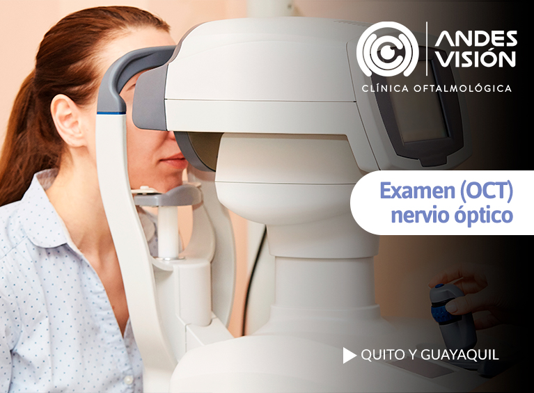Examen OCT de nervio óptico
