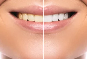 how to remove yellow stains from teeth naturally