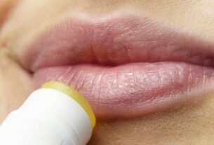 How to Get Rid of Lip Breakouts