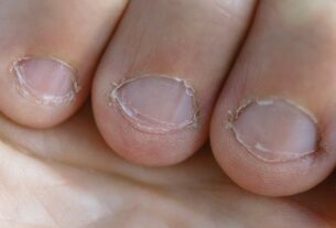 How to Keep Nails From Breaking