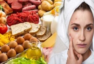 Can Foods Help Reduce Pimples?