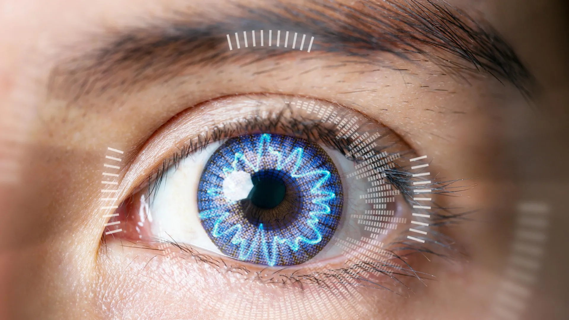 Electricity and Platinum Lenses Could Replace LASIK Vision Surgery