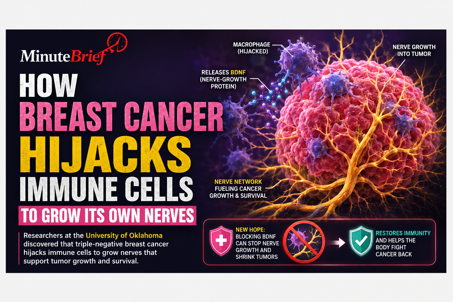 How Breast Cancer Hijacks Immune Cells to Grow Its Own Nerves