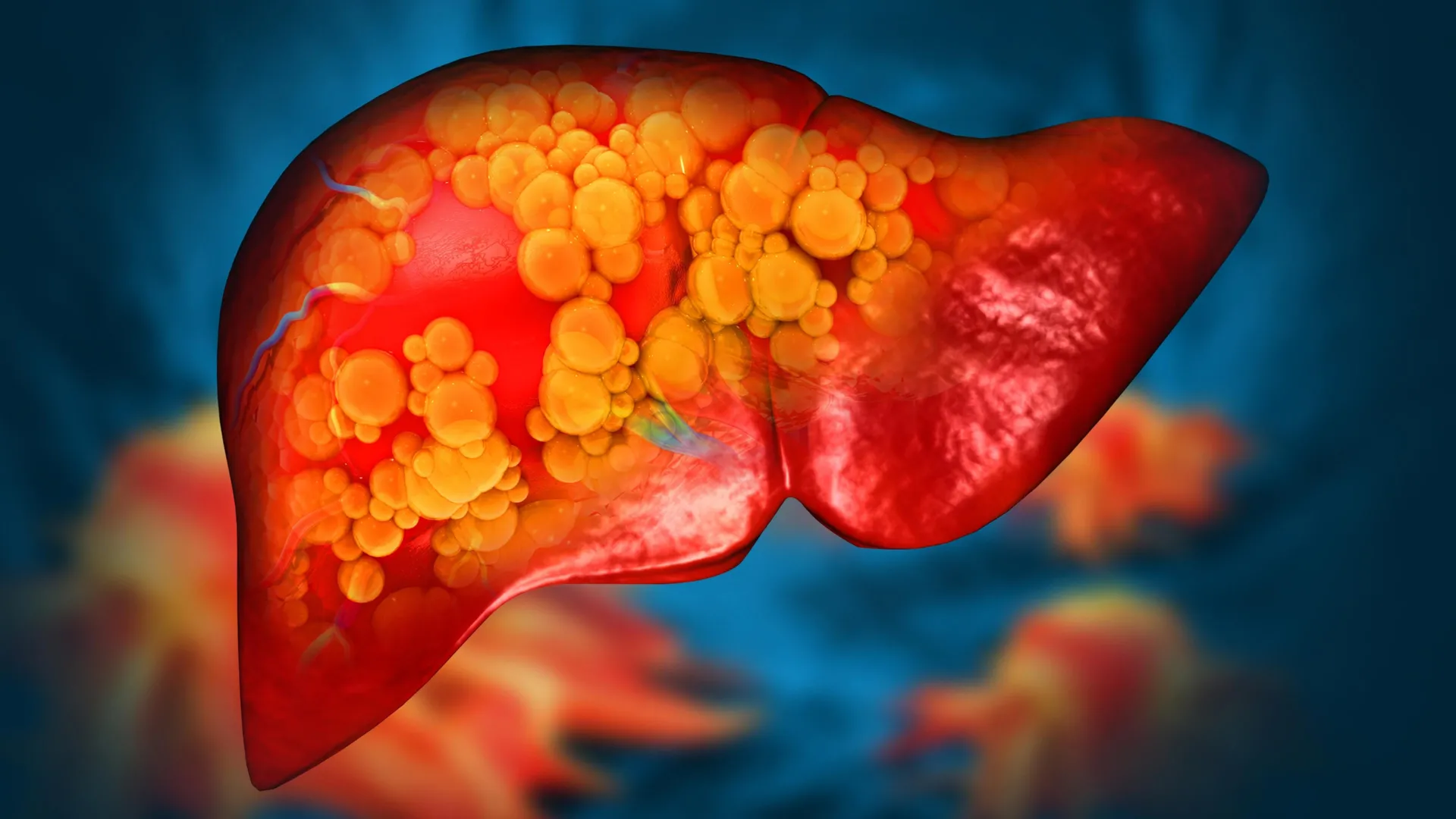 Late-Night Snacking Linked to Increased Risk of Severe Liver Disease, OHSU Study Finds