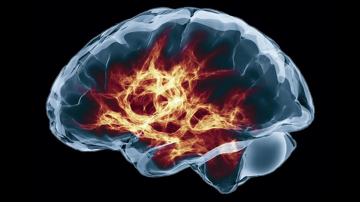 After 30 Years of Research, Science Finally Has a Drug for a Deadly Brain Disease