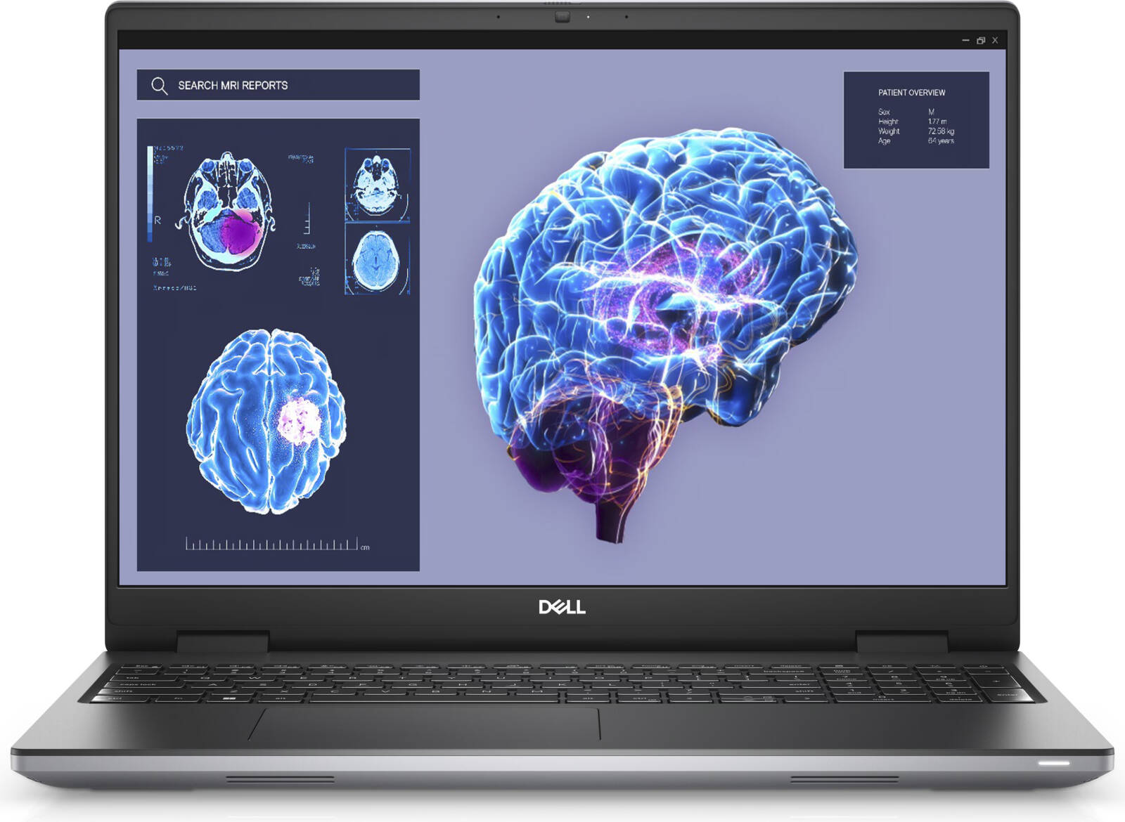 Dell Precision 7680 Workstation, 16″ FHD+ WLED 60 Hz Display, Intel Core i9-13950HX vPro, 64GB RAM, 3TB SSD, NVIDIA RTX 4090 16GB, English K/B, Win 11, Aluminum Titan Grey | P7680I9643 thumbnail 2