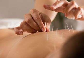 Benefits of acupuncture treatment
