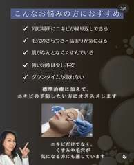 Img 6164