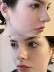 Img 9665