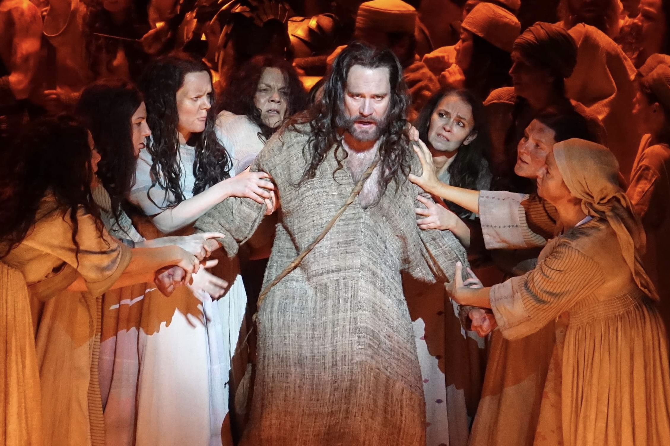 <span><em><u>Media</u></em></span>