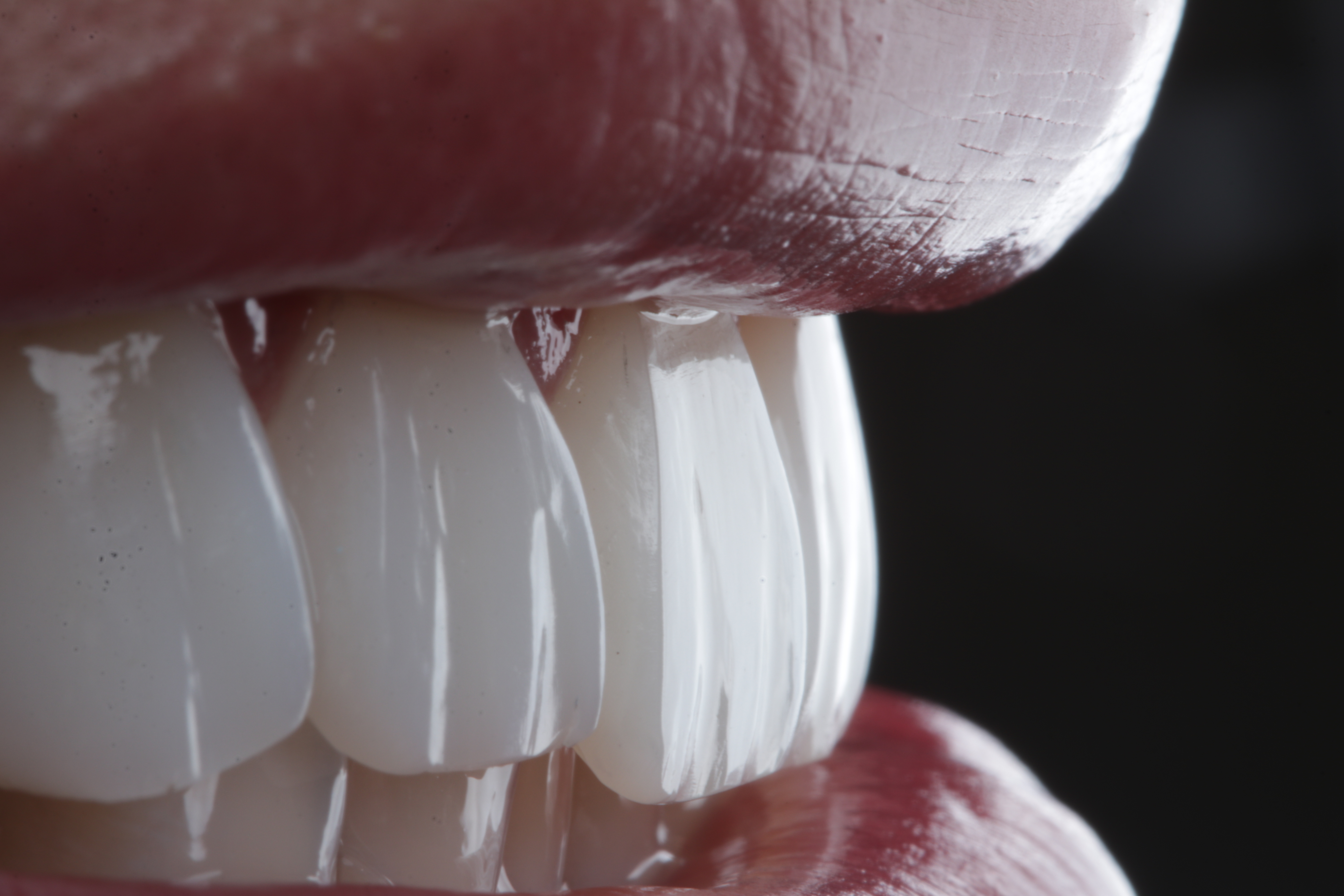 Minimally Invasive Treatments