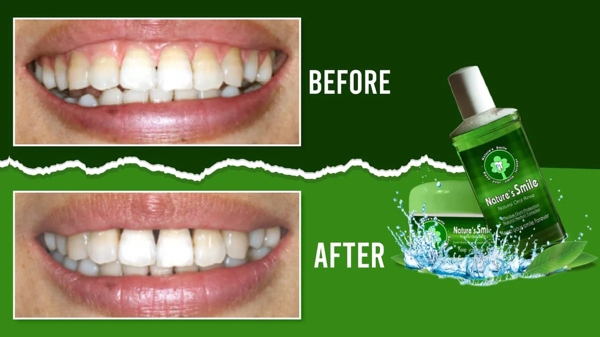 <span>What Is Nature’s Smile and How Does It Work?</span>