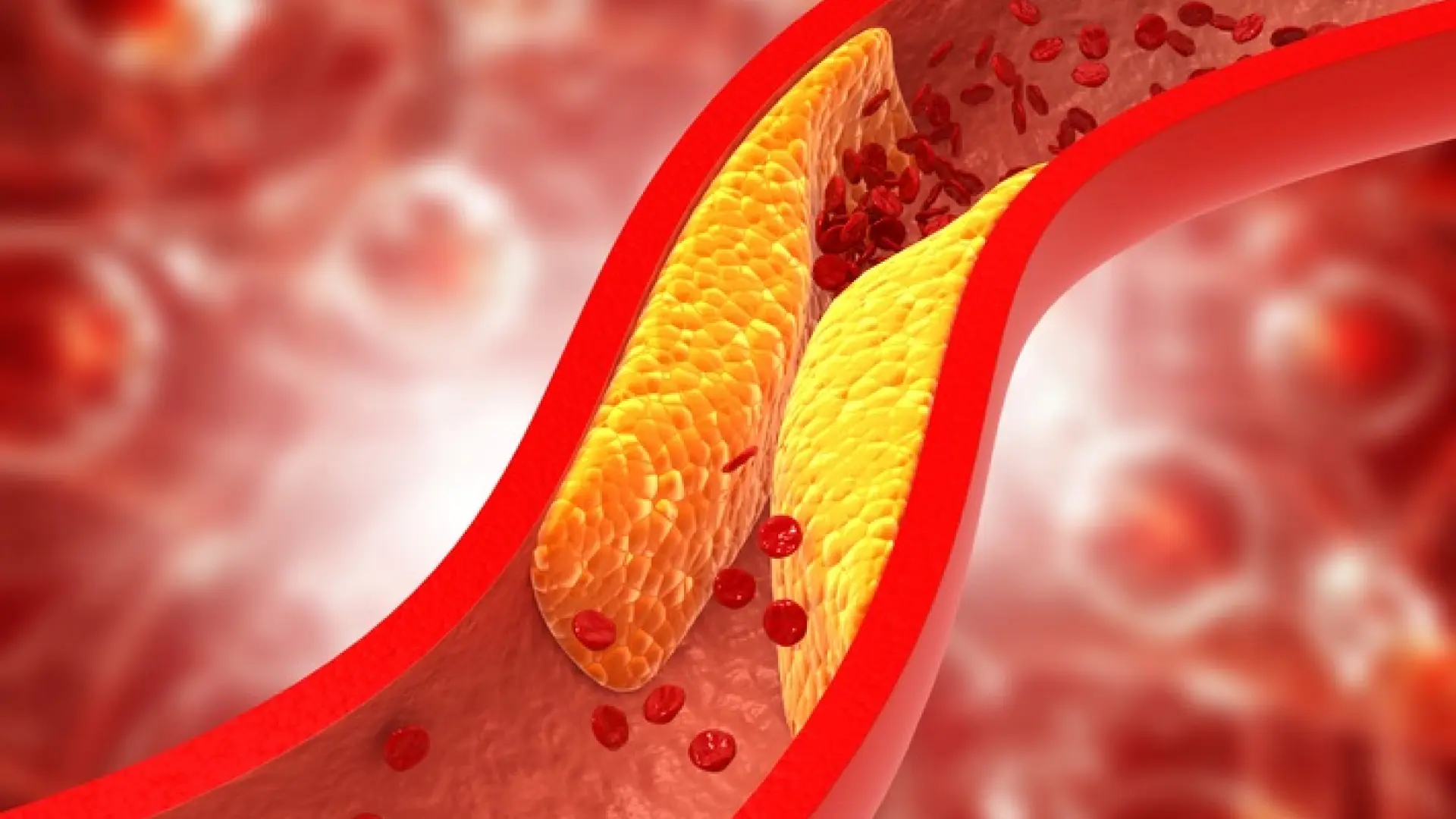 Mejora tu salud cardiovascular