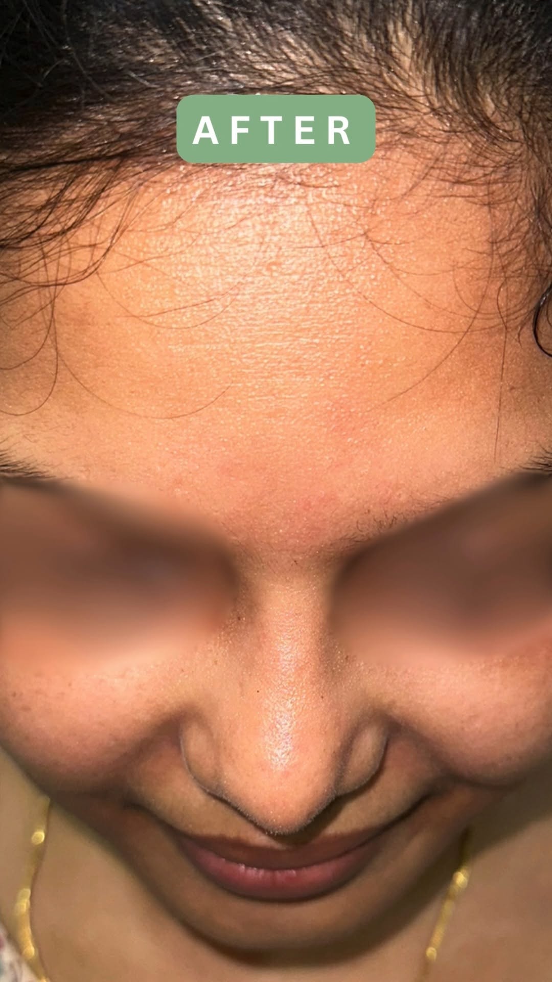 Before & After Results