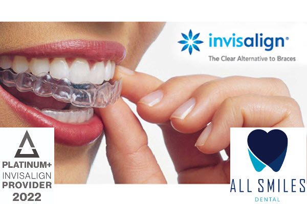 Invisalign Mt Albert - Clear Braces Orthodontics All Smiles Dental