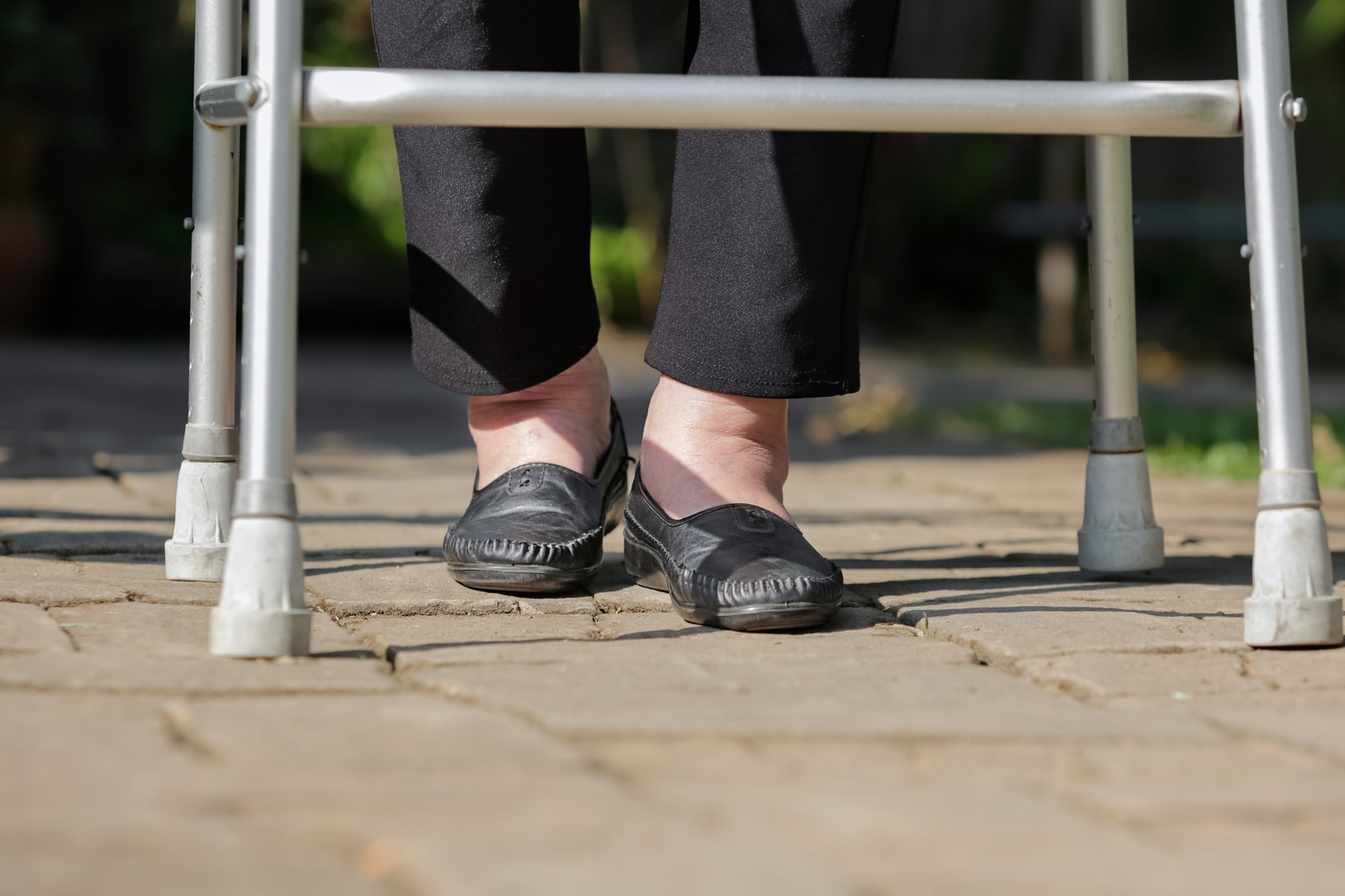 Elderly woman swollen feet using walker in backyard