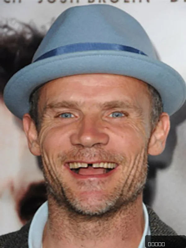 Flea — photo 4