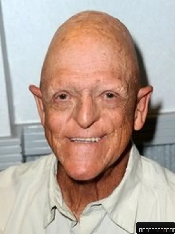 Michael Berryman
