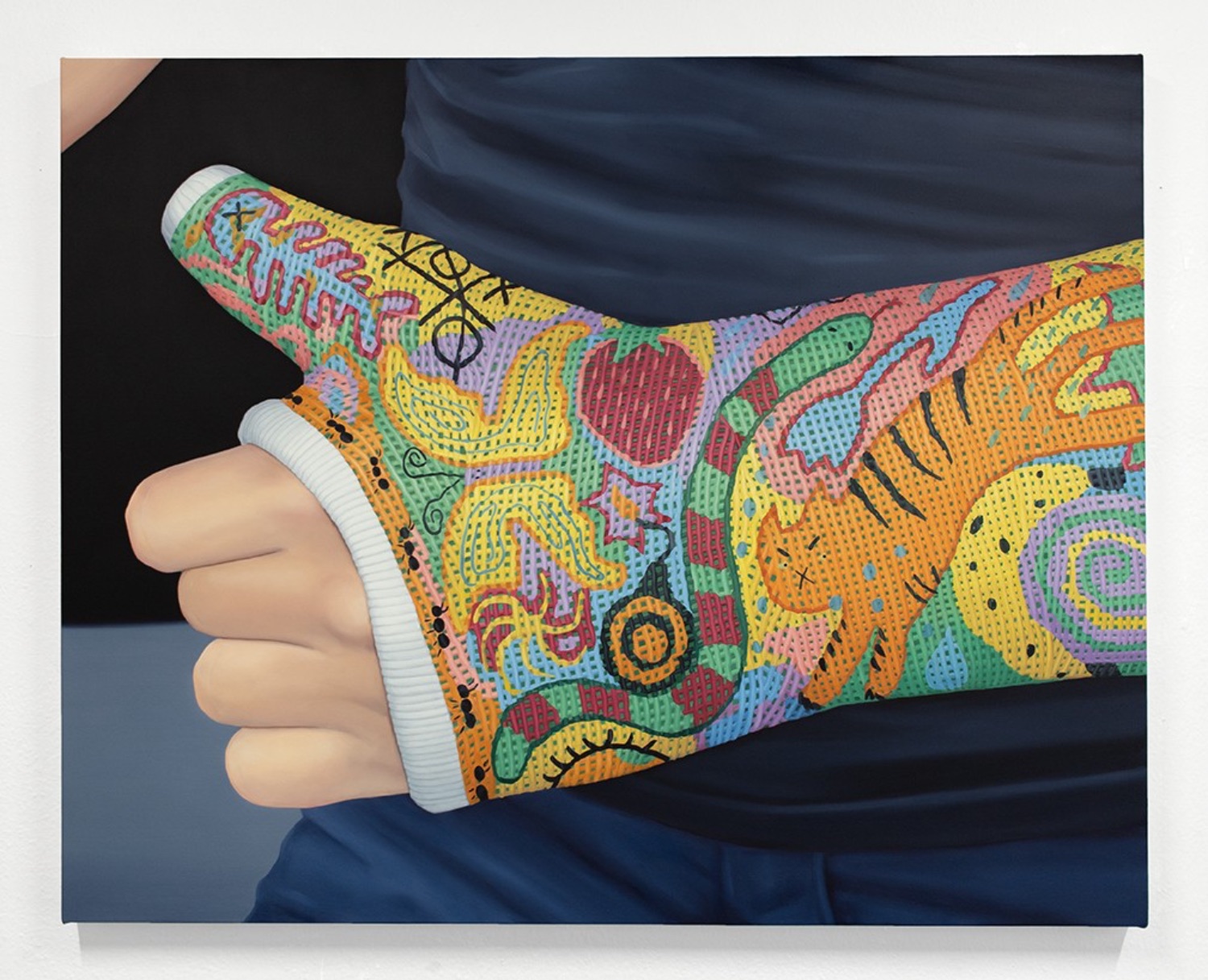 Painting of a broken arm cast covered in drawings