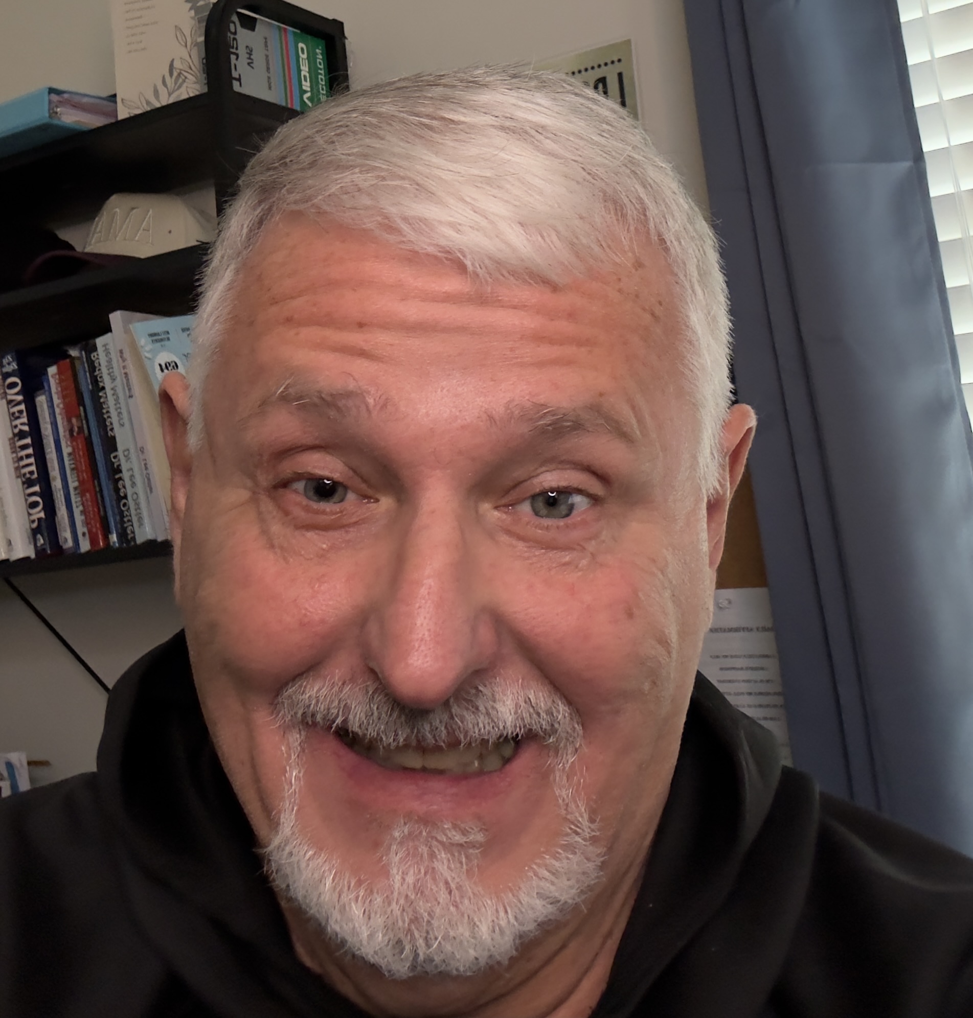 After surgery of second eye After surgery of second eye