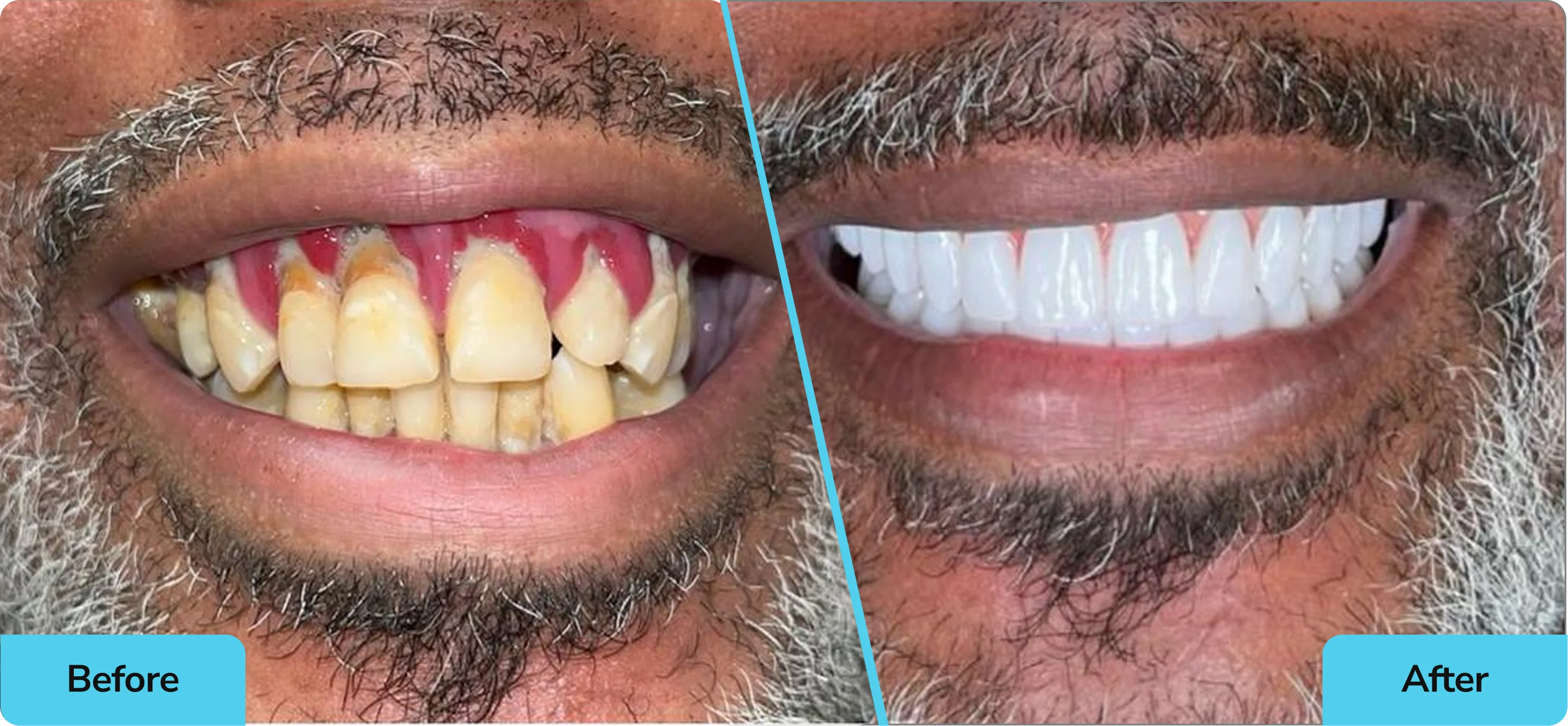 Voit Dental Hero Image