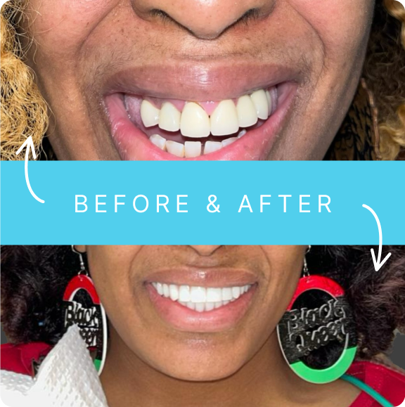 Before transformation 3