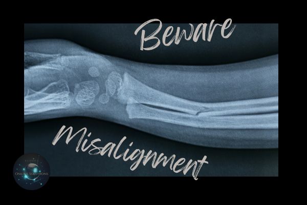 An X-ray image of a misaligned bone with the words 'Beware Misalignment,' symbolizing the blog's message about the dangers of misalignment between brand values and business practices, which can damage reputation and erode customer trust.